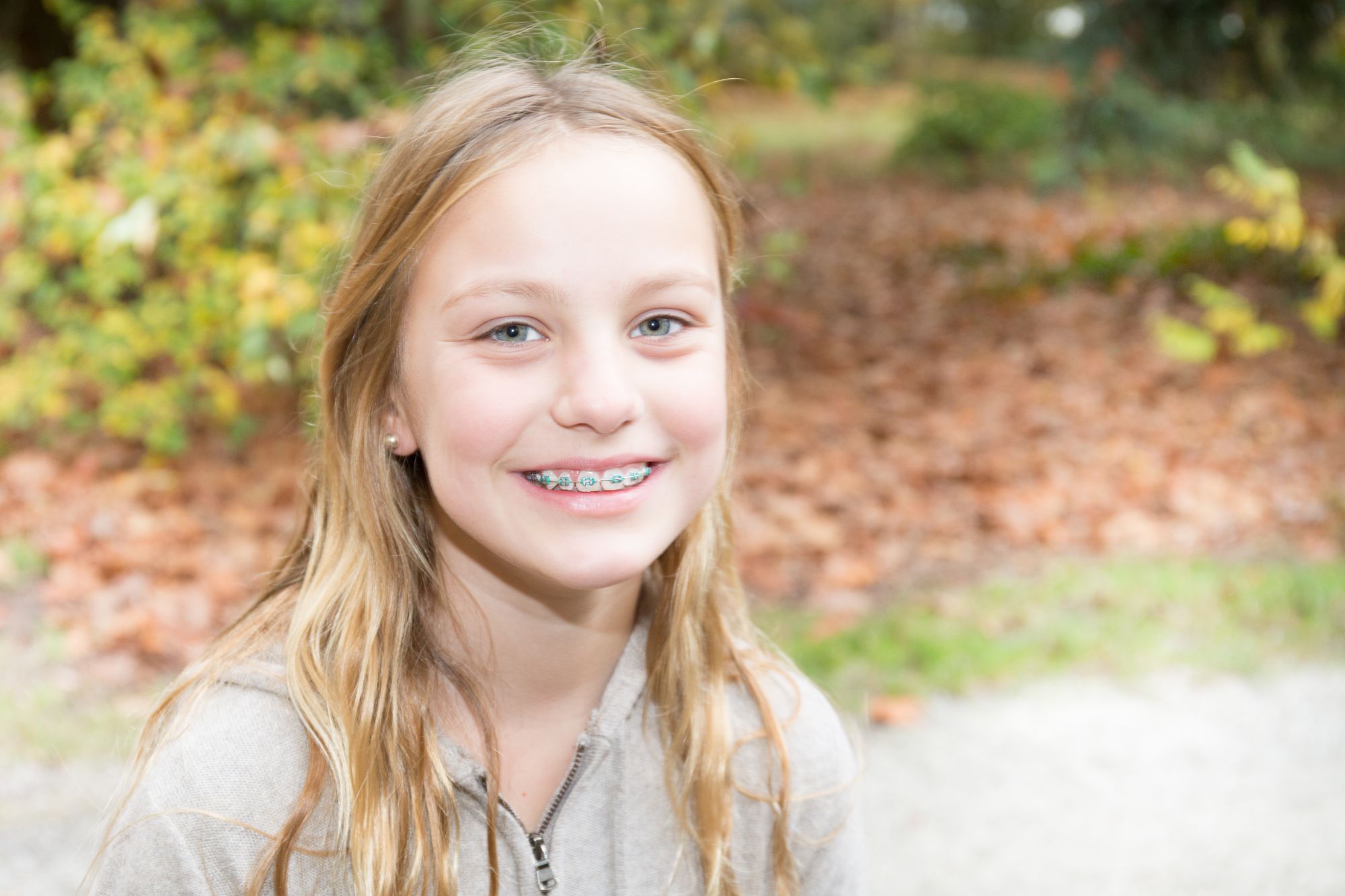 AdobeStock_199022723 orthodontist brooklyn ny