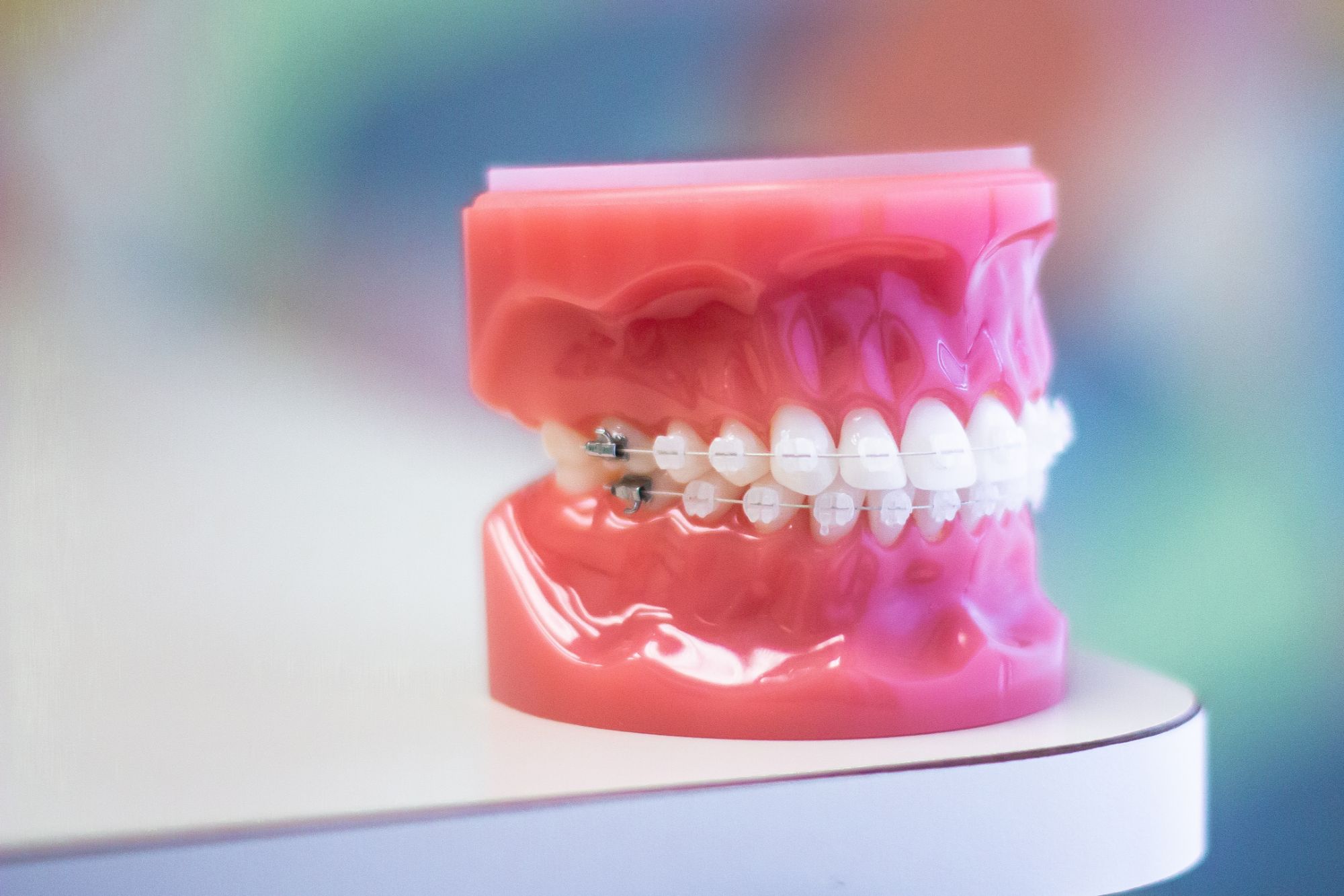 IMG_5747 orthodontics brooklyn ny