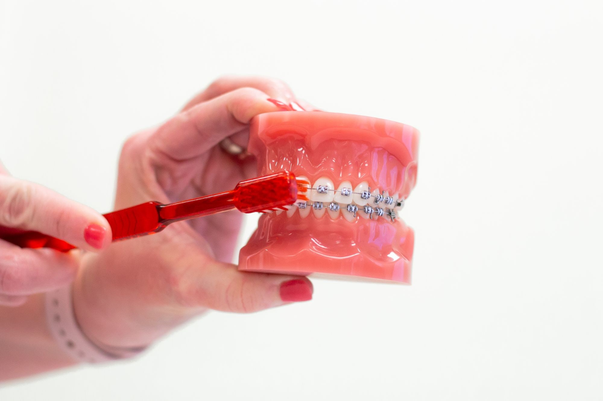 IMG_5931 orthodontics brooklyn ny